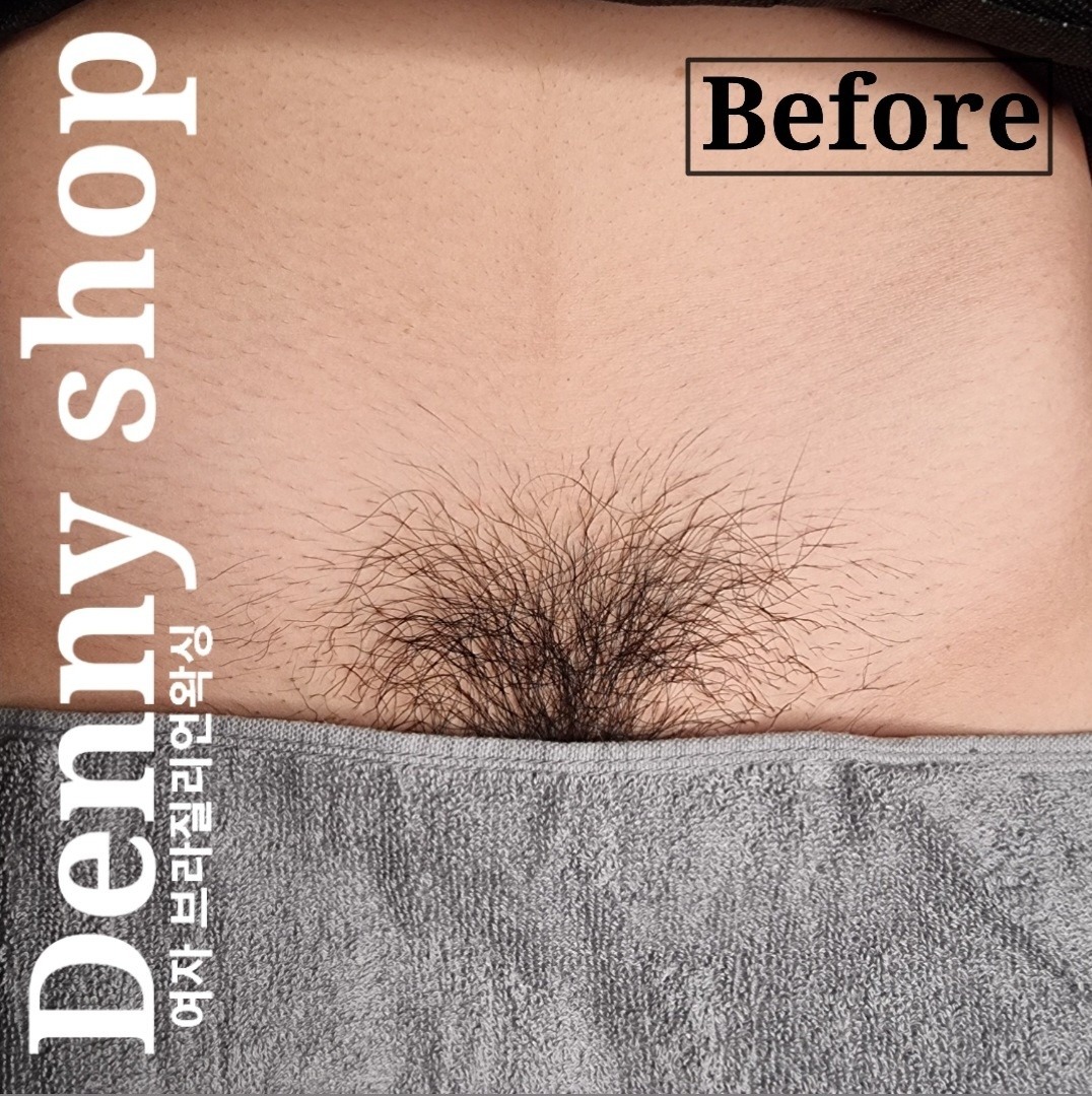 대구 왁싱] 상인동 여자 브라질리언 왁싱 | 대구광역시 달서구 상인동 | 왁싱 | 당근 비즈 소식