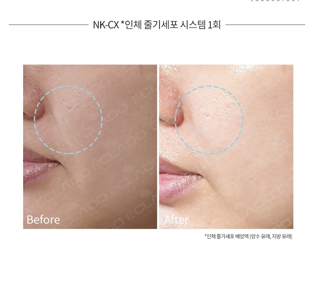 라임뷰티  picture 1