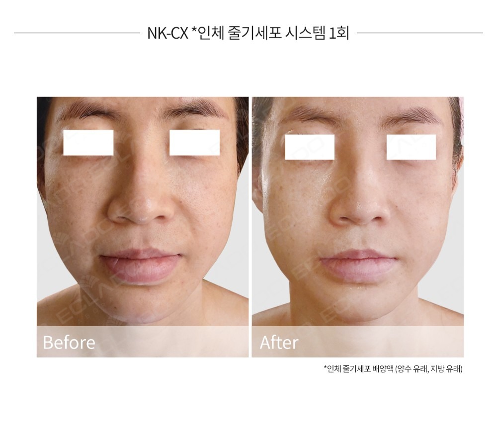 라임뷰티  picture 2