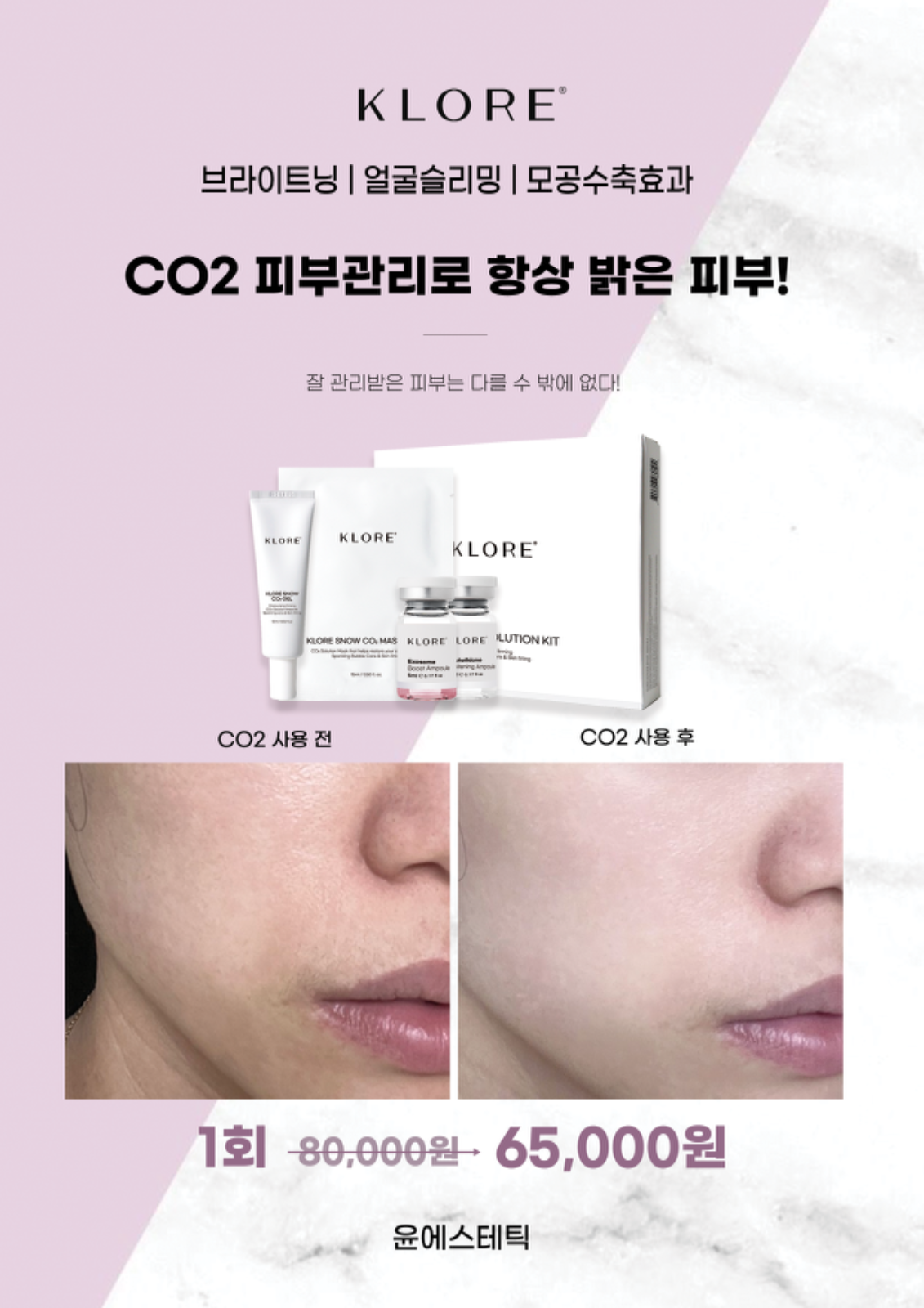 Co2 피부관리 깜짝 이벤트🧨