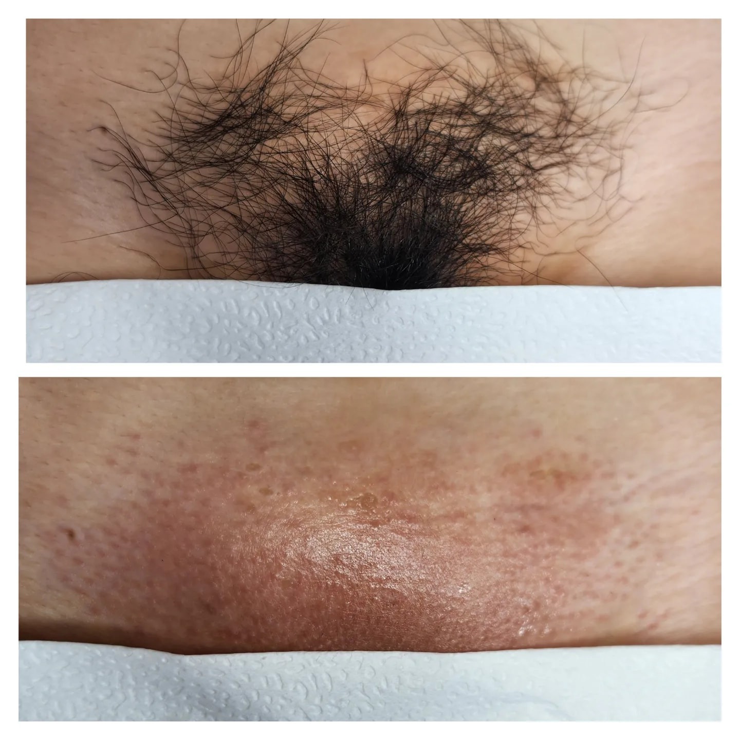 📍생식기질환 예방 필수 브라질리언왁싱 | 부산광역시 남구 문현동 | 왁싱 | 당근 비즈 소식