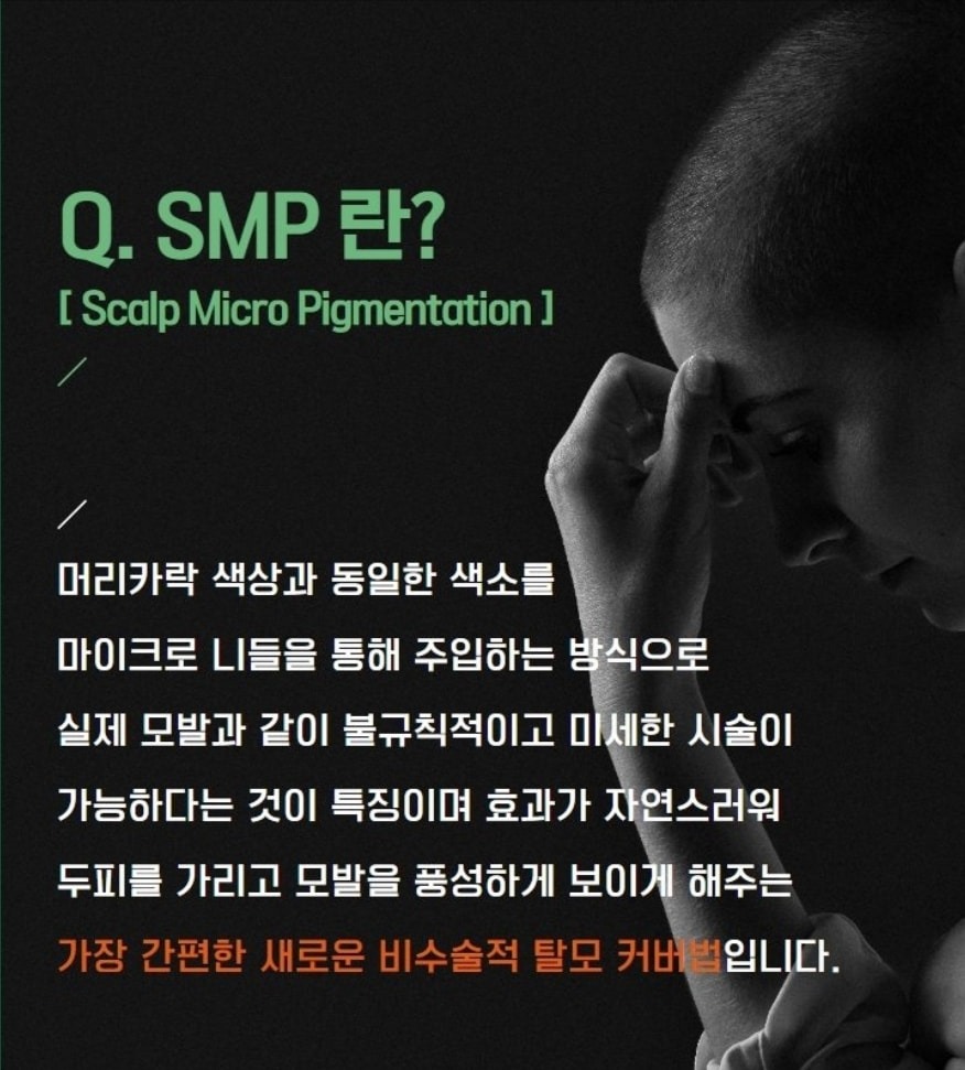 SMP두피클리닉 50%할인행사