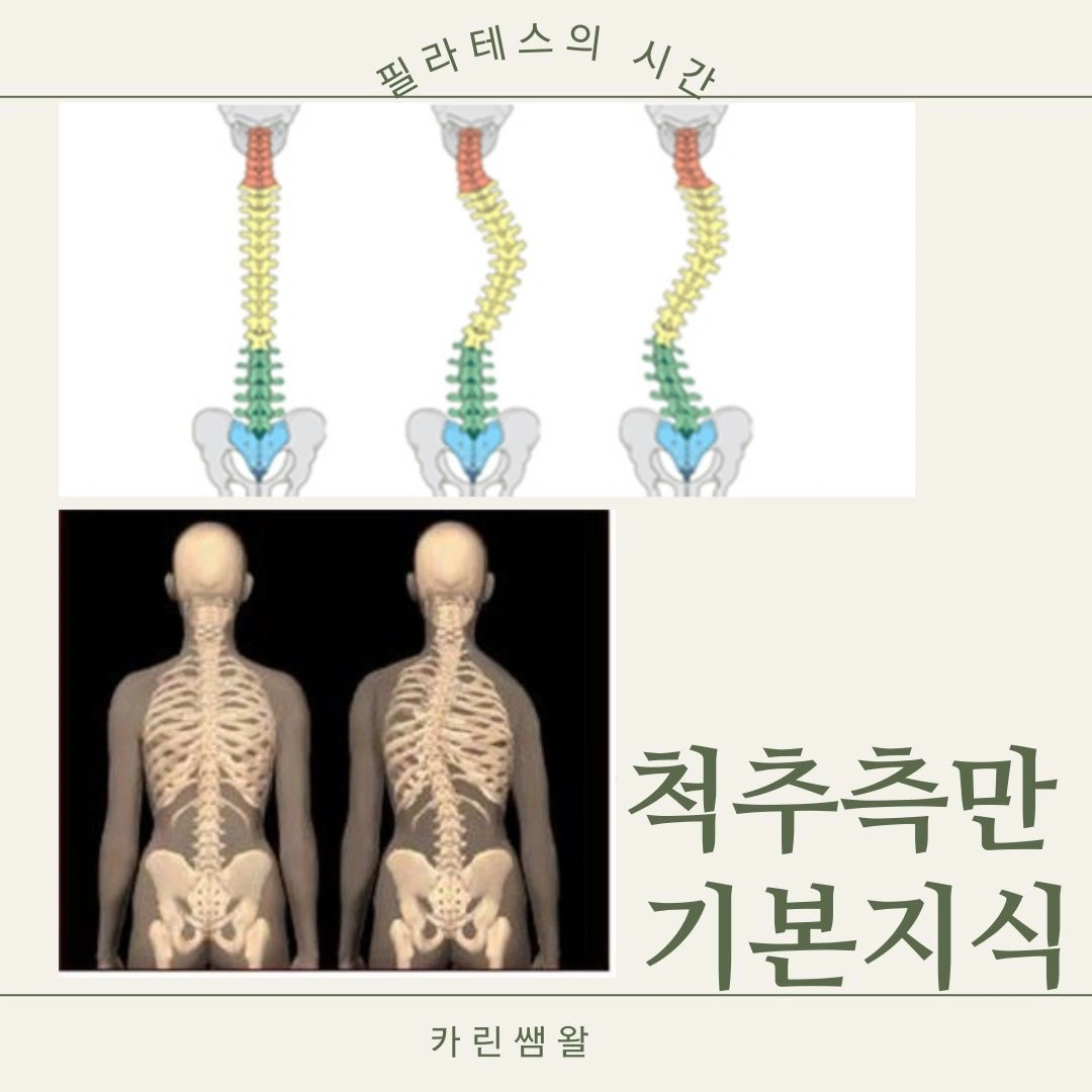 척추 측만 기본 지식 -1 - 경기도 부천시 옥길동 | 비즈프로필