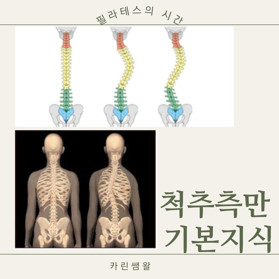 척추 측만 기본 지식 -1 - 경기도 부천시 옥길동 | 비즈프로필