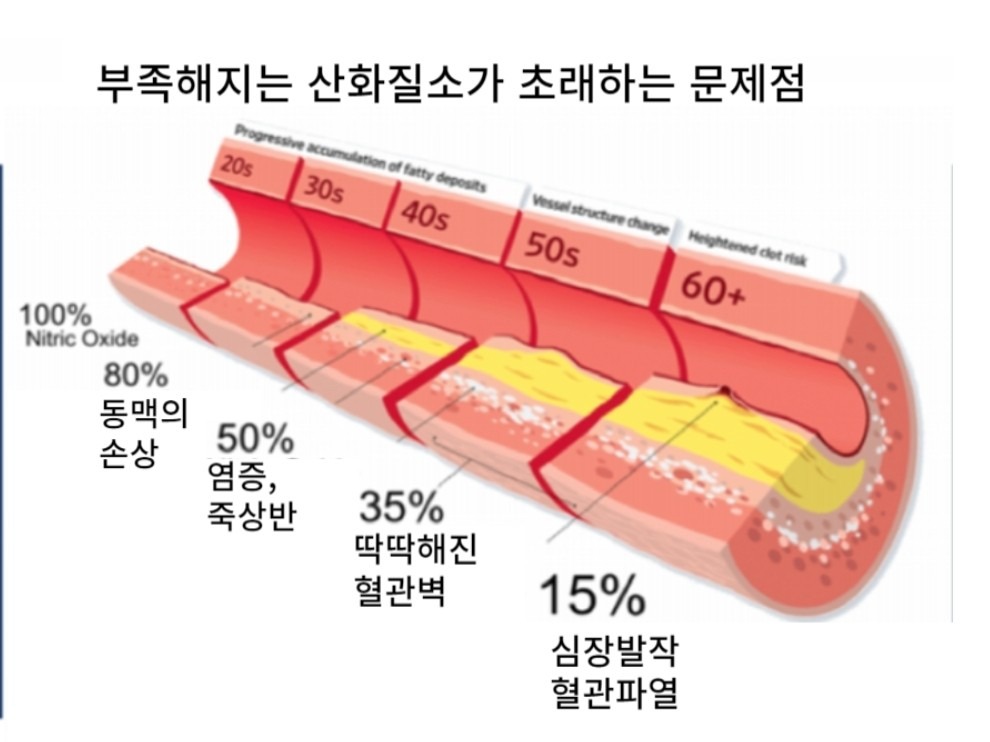 산화질소 건강관리 영양제 - 전라북도 익산시 왕궁면 | 비즈프로필