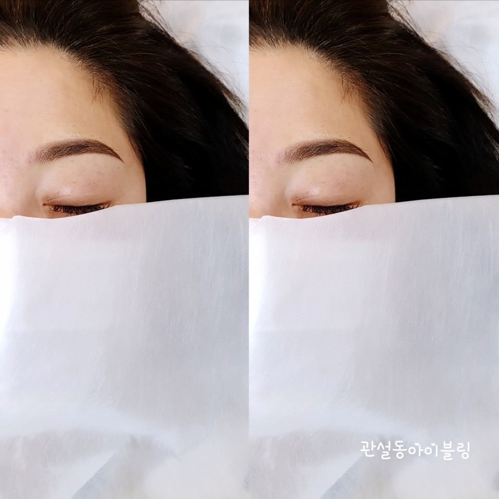 아이블링 picture 0