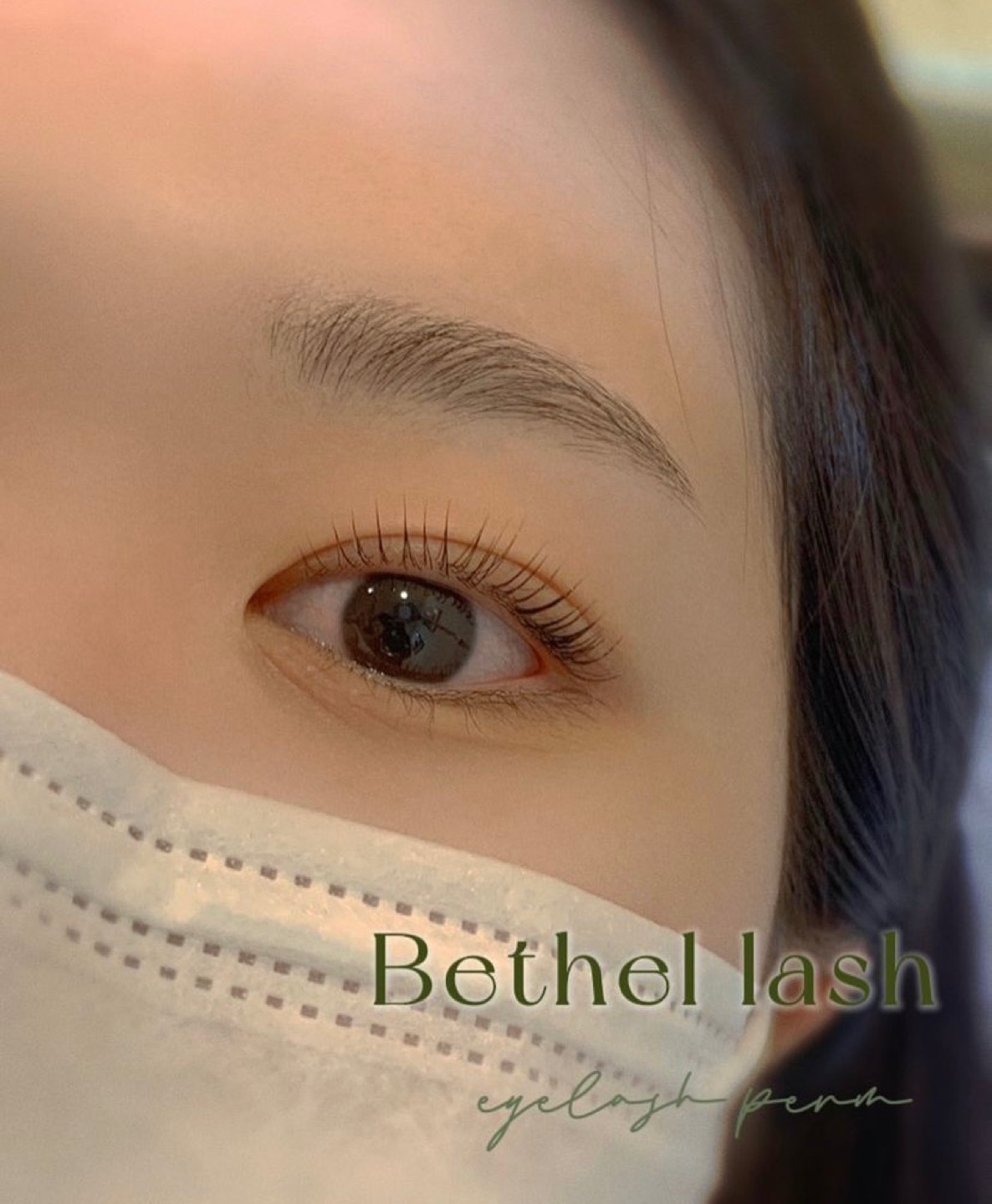 베델래�쉬 picture 8