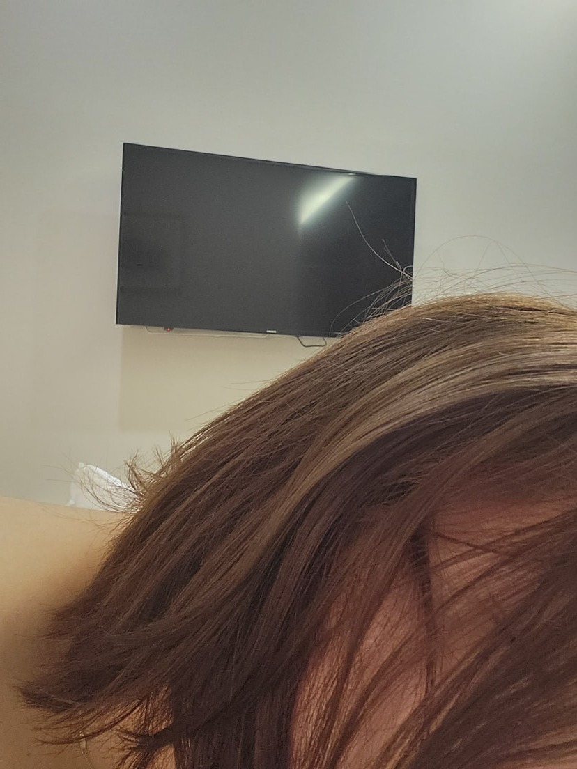 버니헤어 picture 1