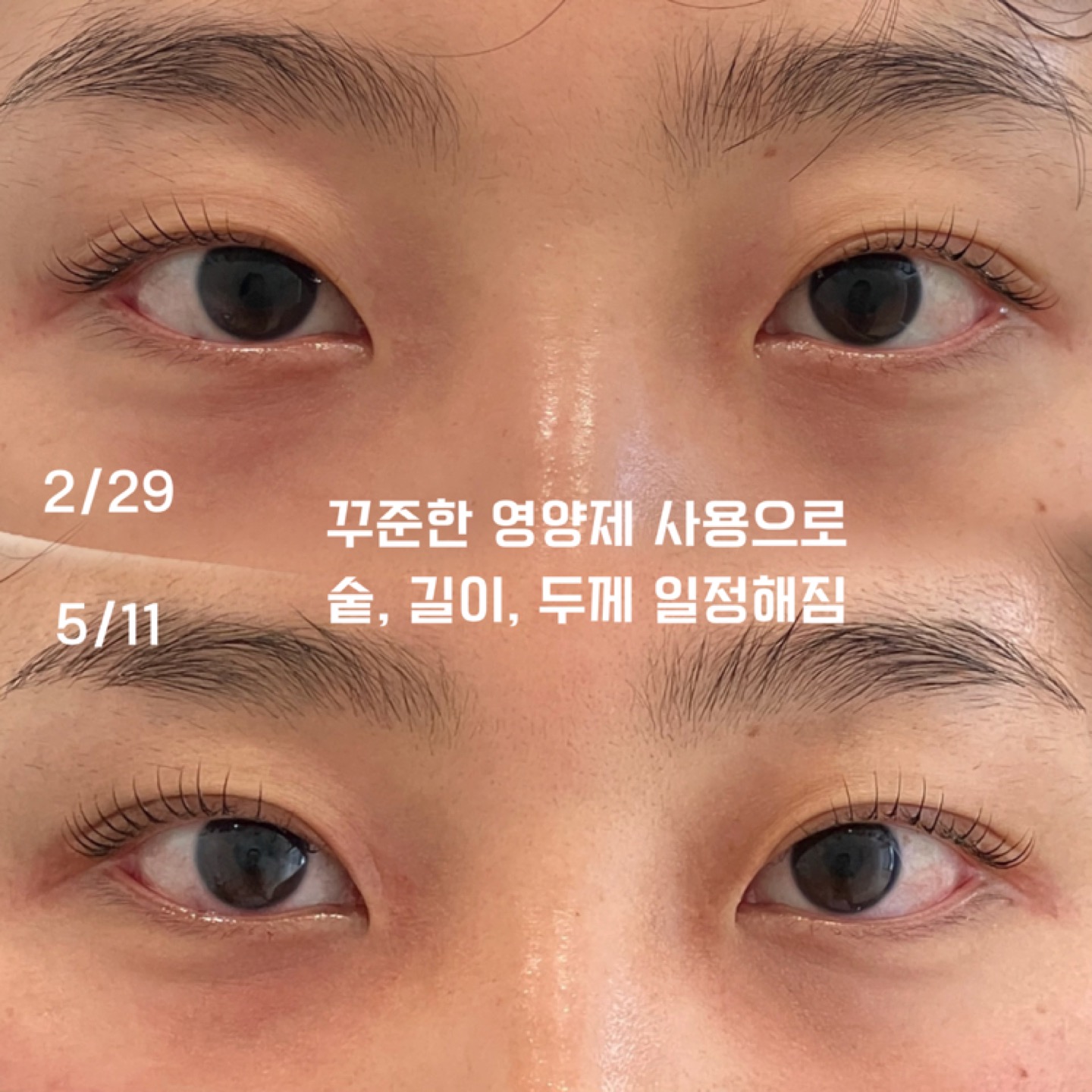 투명영양제 1만원 할인 ! 2달만에 눈으로 보이는 효과, 믿고 써보세요 :)