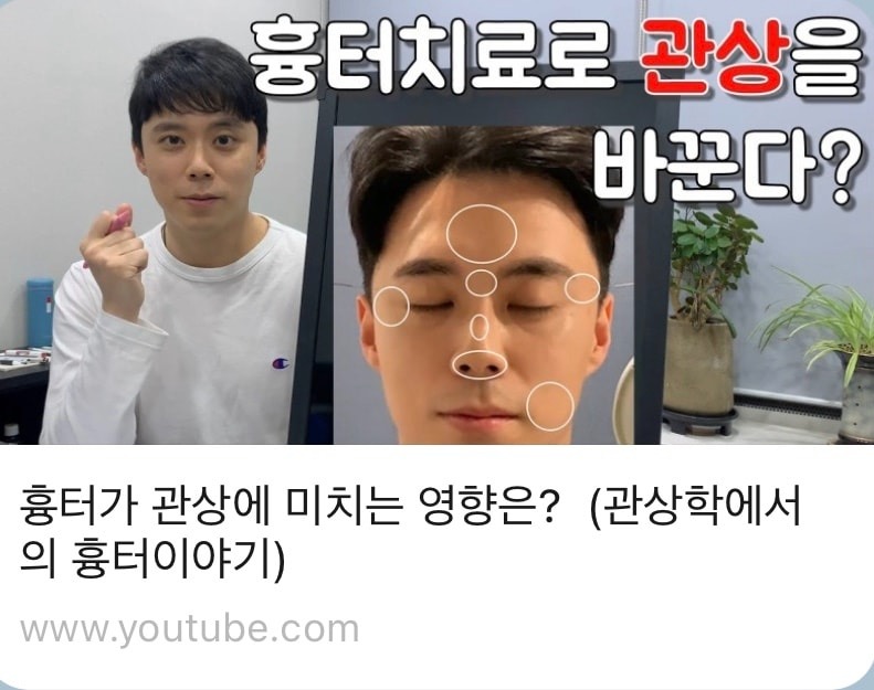 흉터 치료로 관상을 바꾼다?🧐