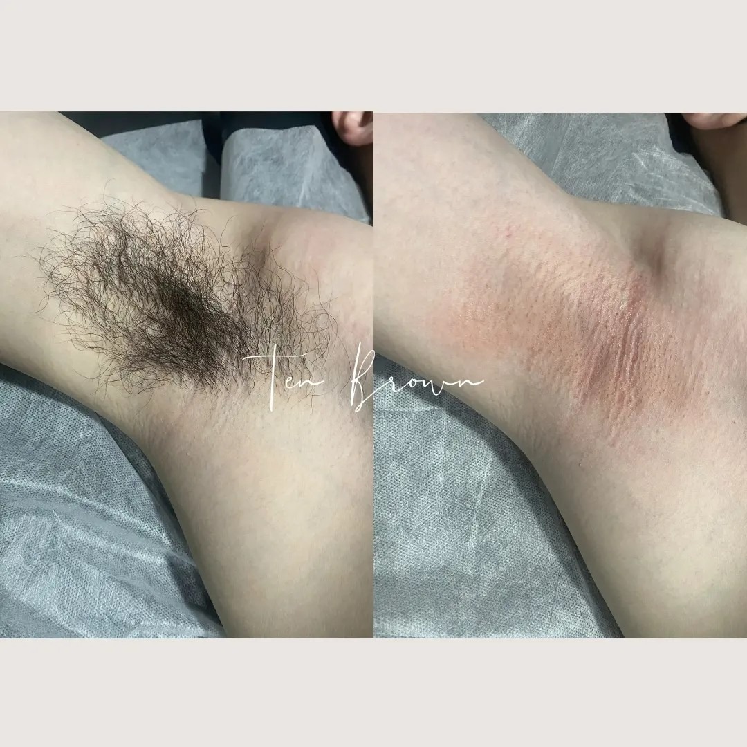 브라질리언 왁싱 할인 이벤트 ❤️ | 경기도 수원시 팔달구 인계동 | 왁싱 | 당근 비즈 소식