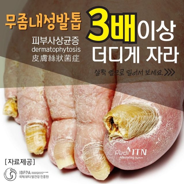 보민 바디&네일 케어