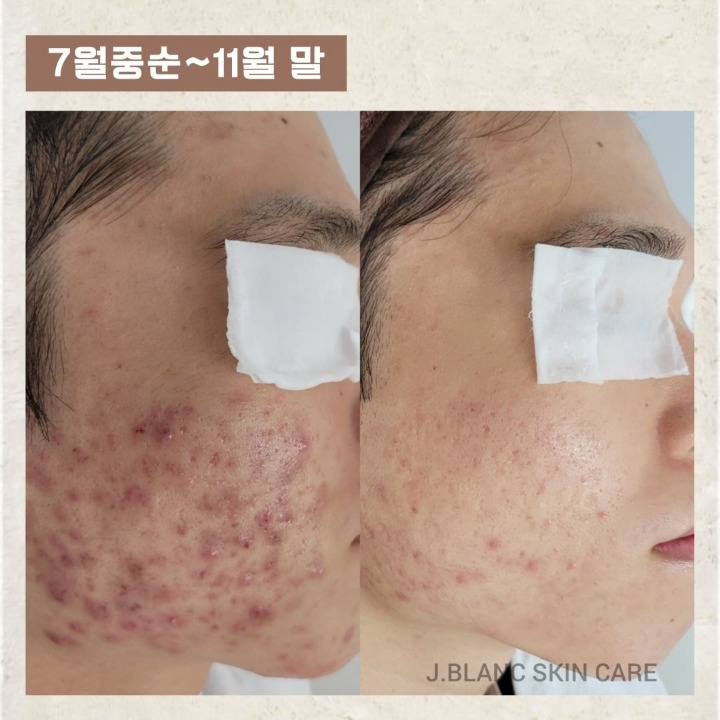 블랑 드 제이 에스테틱