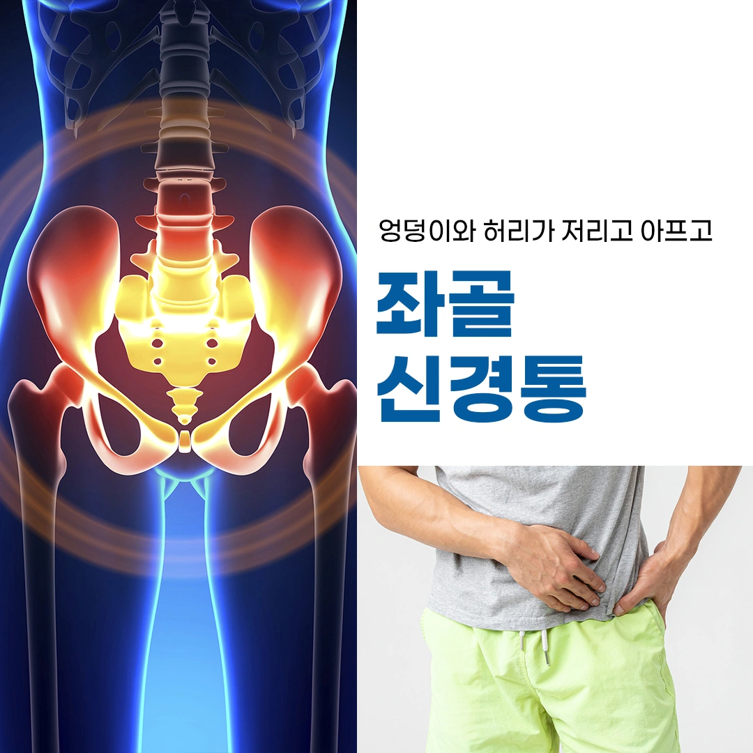 허벅지와 엉덩이가 아프고 저린 증상, 좌골신경통 - 부산광역시 동래구 온천동 | 비즈프로필