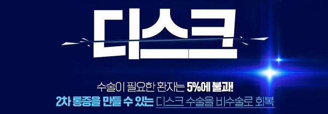 디스크 양한방으로 치료하기