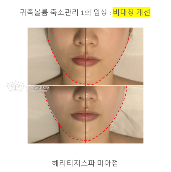 헤리티지스파 피부관리 전문 picture 0