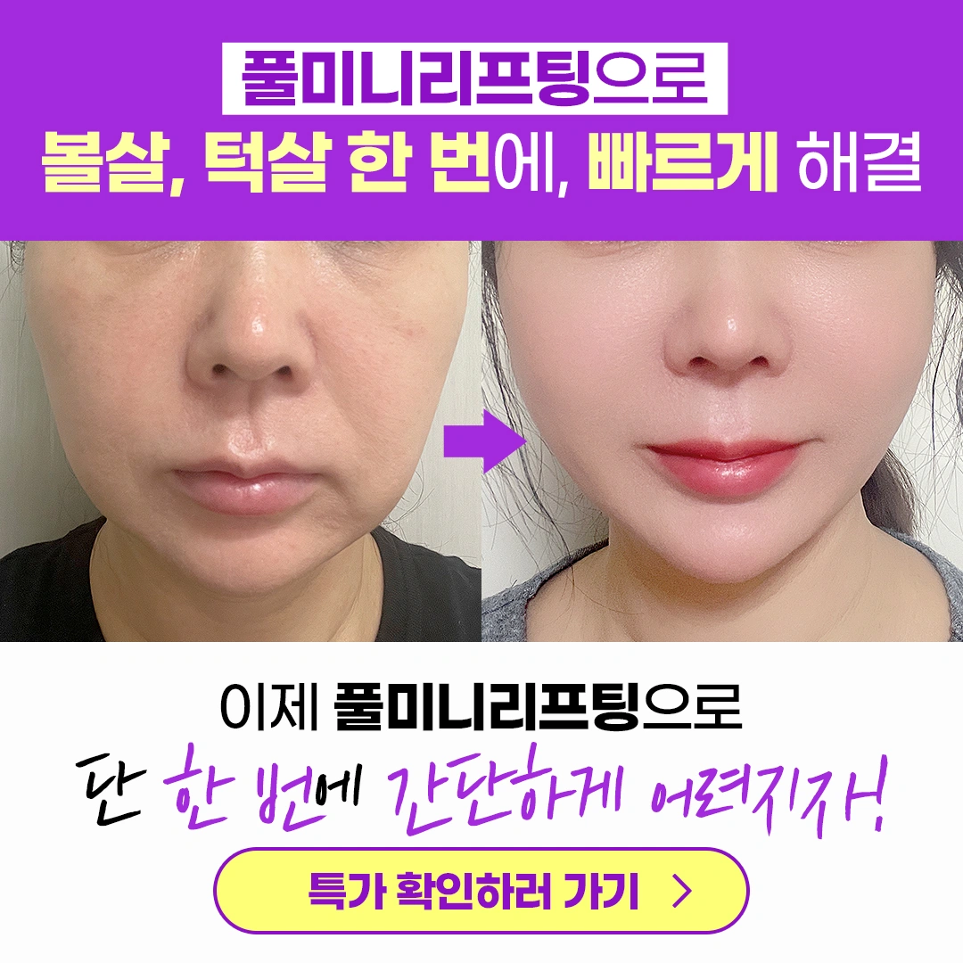 볼살, 턱살 빠르게 해결! | 서울특별시 강남구 역삼동 | 성형외과 | 당근 비즈 소식