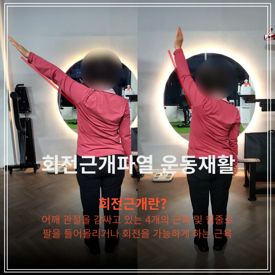 회전근개 파열 운동재활PT | 서울특별시 마포구 노고산동 | 헬스 | 당근 비즈 소식