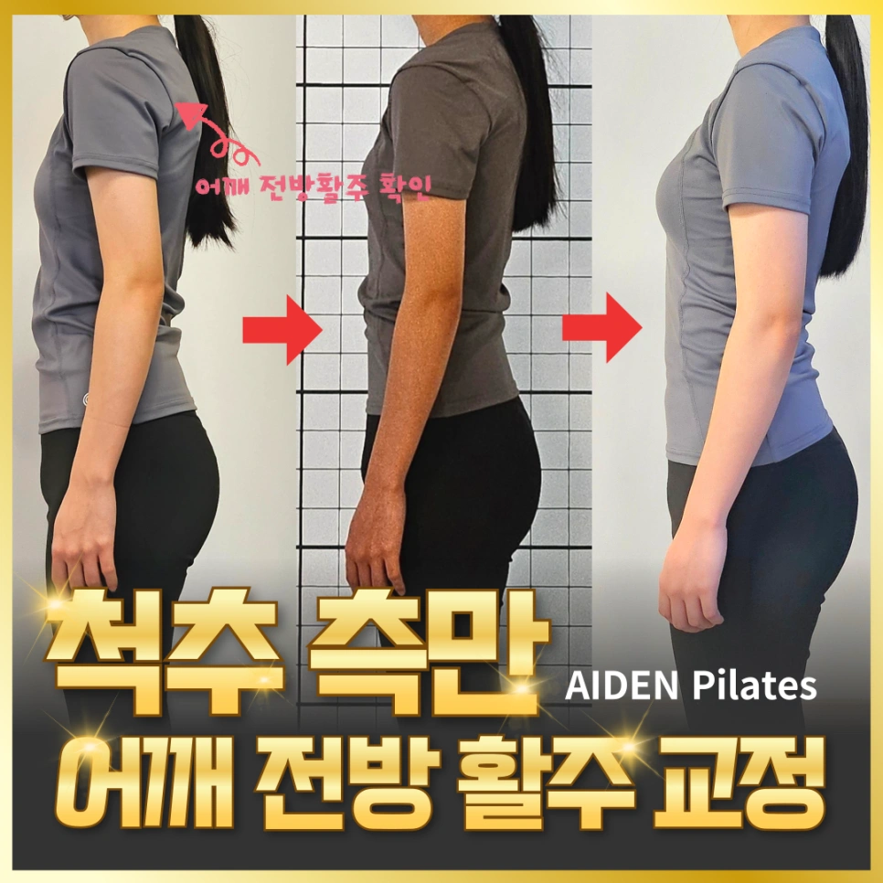 척추 측만, 어깨 전방 활주 교정 운동재활PT | 광주광역시 남구 봉선동 | 헬스 | 당근 비즈 소식