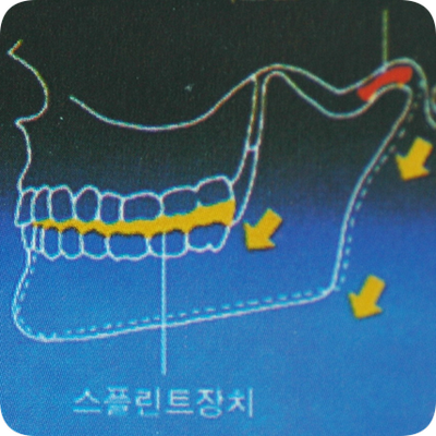 [원장칼럼] 턱관절치료: 어떻게 하면 턱이 좋아지나요? | 서울특별시 강남구 신사동 | 치과의원 | 당근 비즈 소식