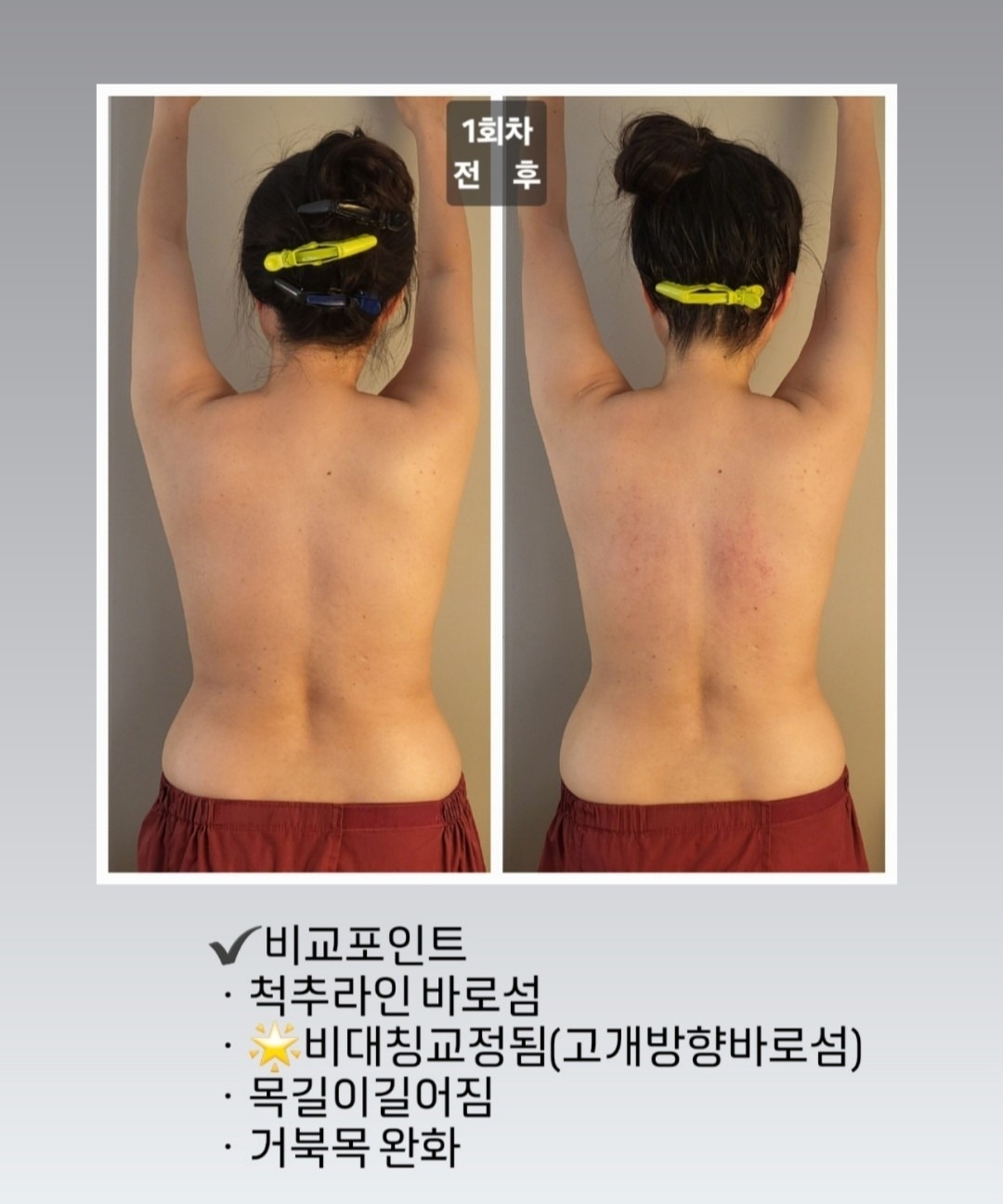 에스테틱 더슬림 picture 2