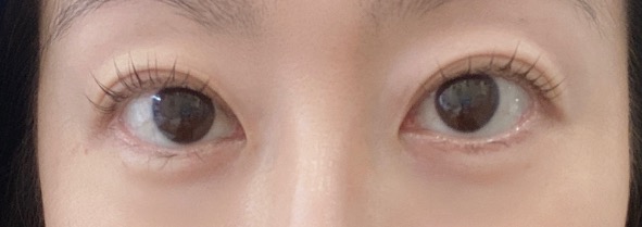 브로우 피터 picture 1