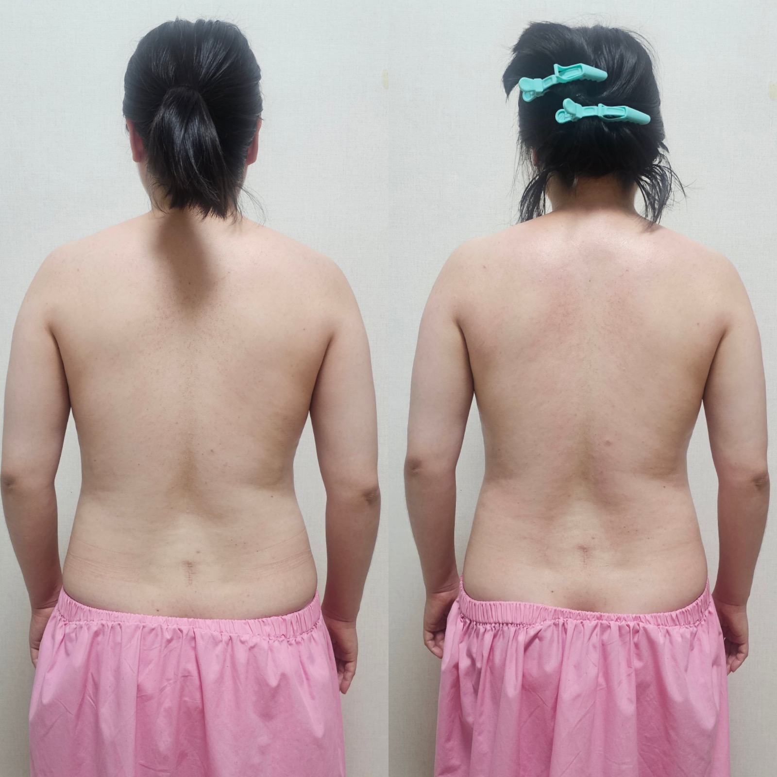 더슬림 림프순환 picture 4