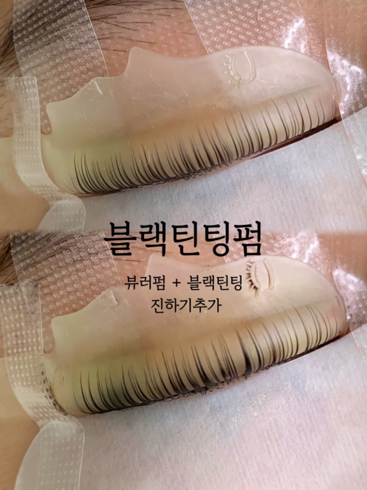 뷰티콩 picture 5