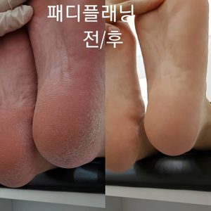패디플래닝