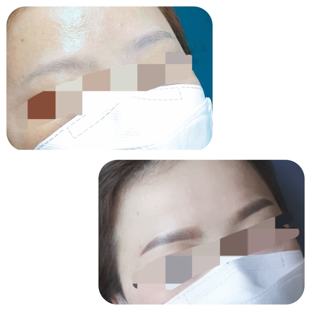 렛미인스킨케어 picture 5