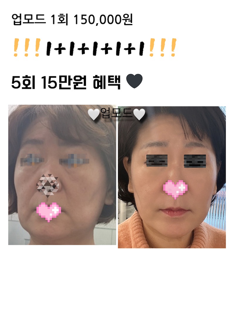 라비나뷰티 picture 2