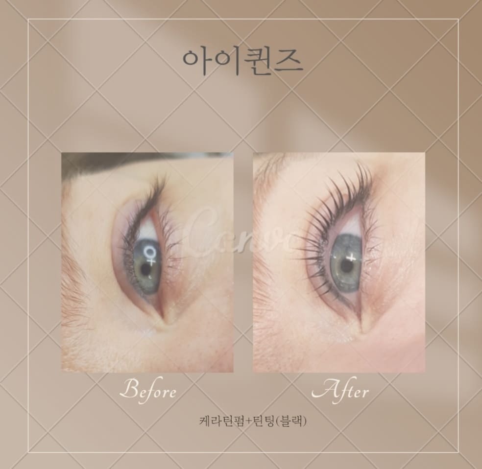 아이퀸즈 picture 0