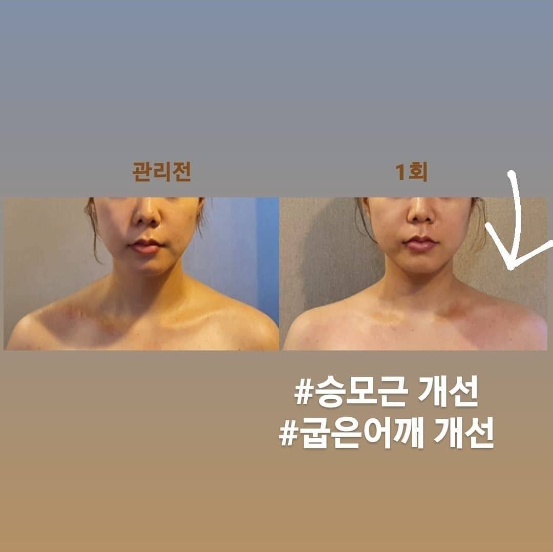 작은얼굴바른체형 picture 1