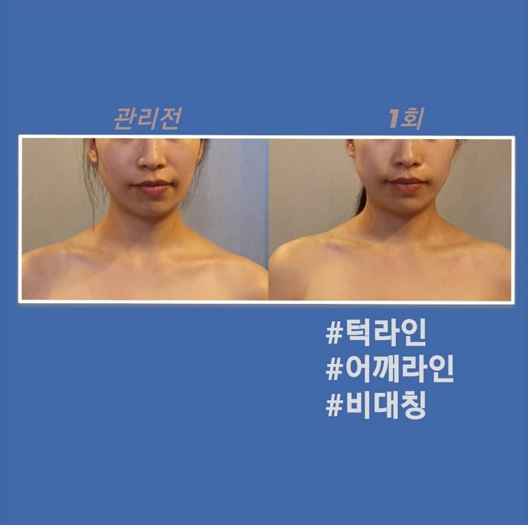 작은얼굴바른체형 picture 3