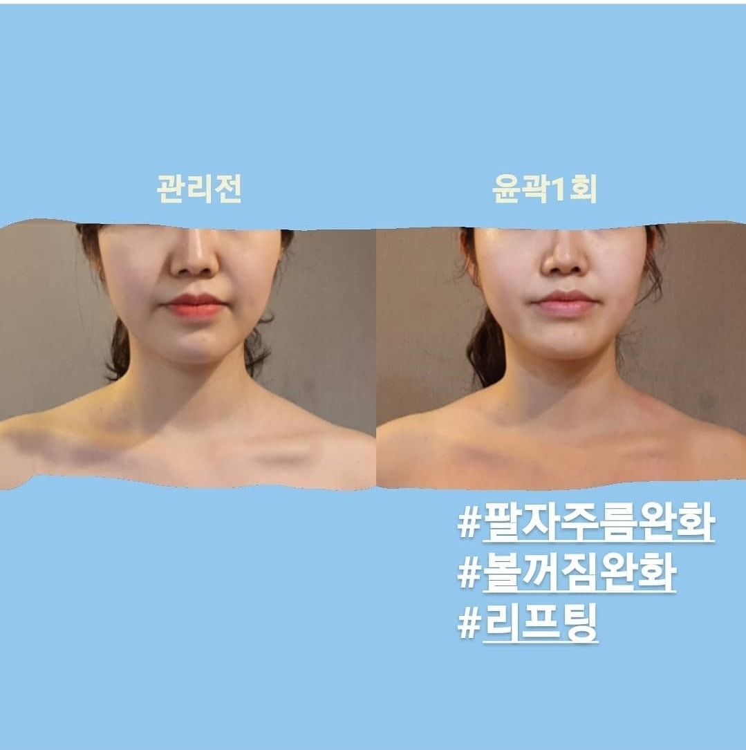 작은얼굴바른체형 picture 5