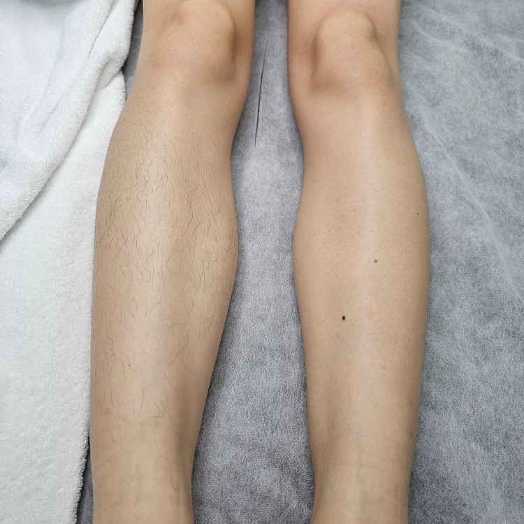 민뷰티왁싱엔페이스 picture 5