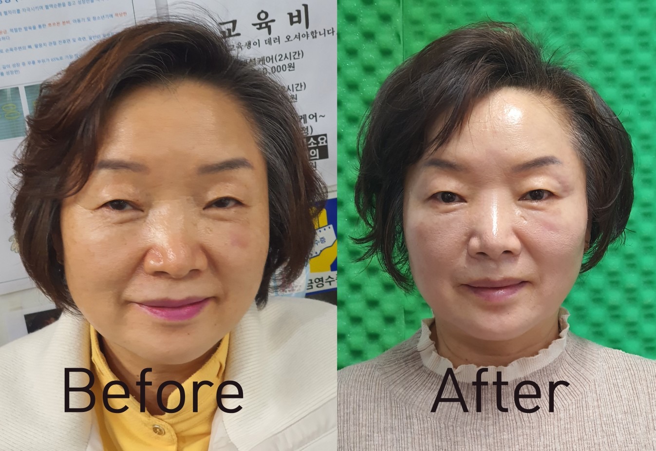 러브온미피부관리 picture 4