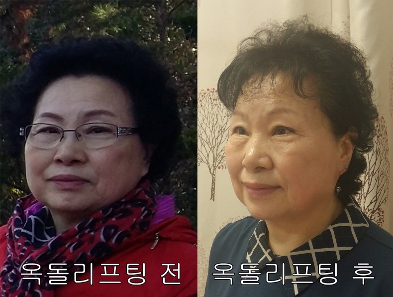 러브온미피부관리 picture 5
