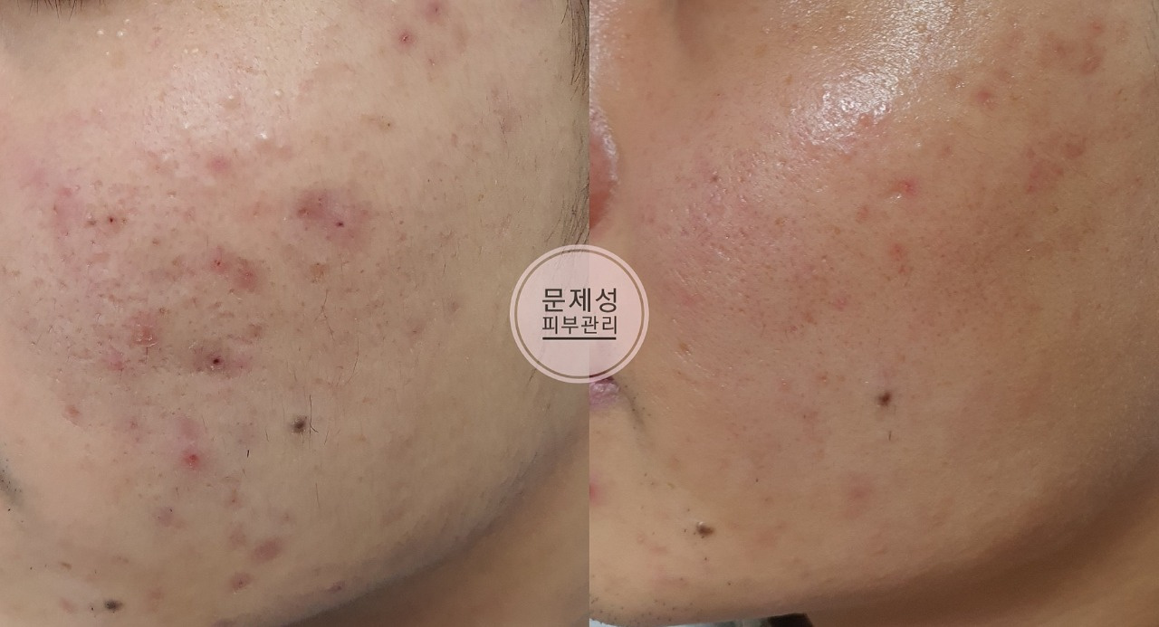 피부관리 인천 숭의점