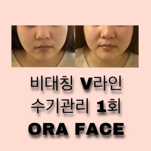 오라페이스