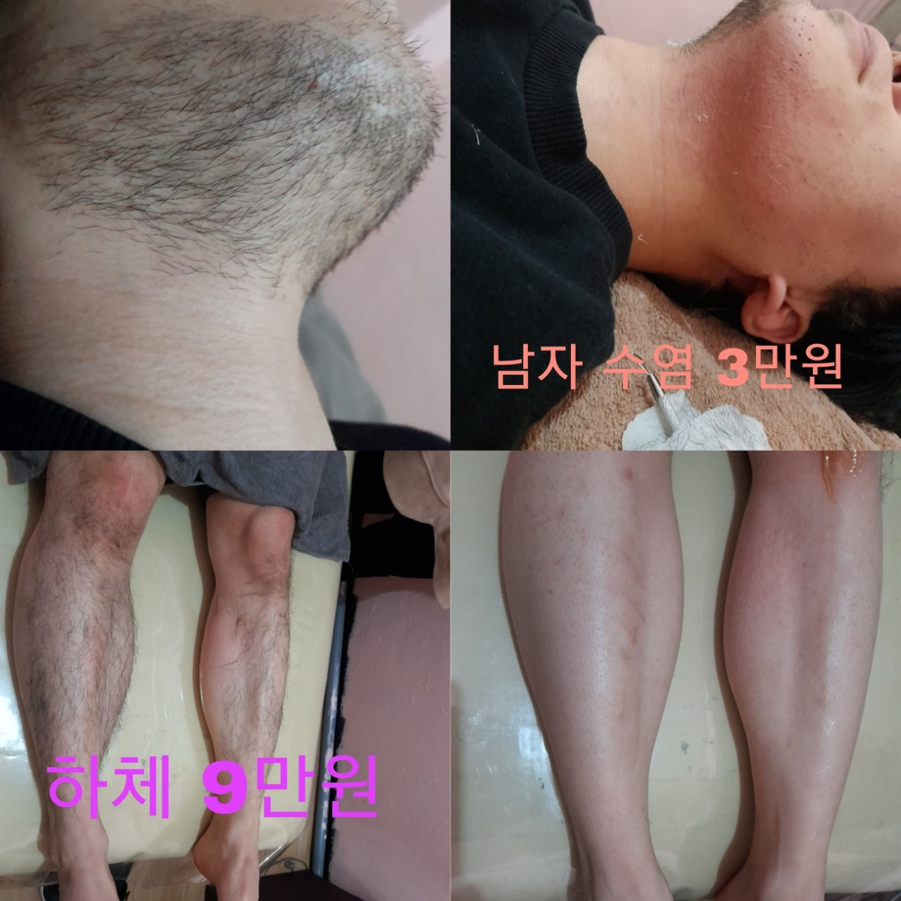 프린세스 테라피