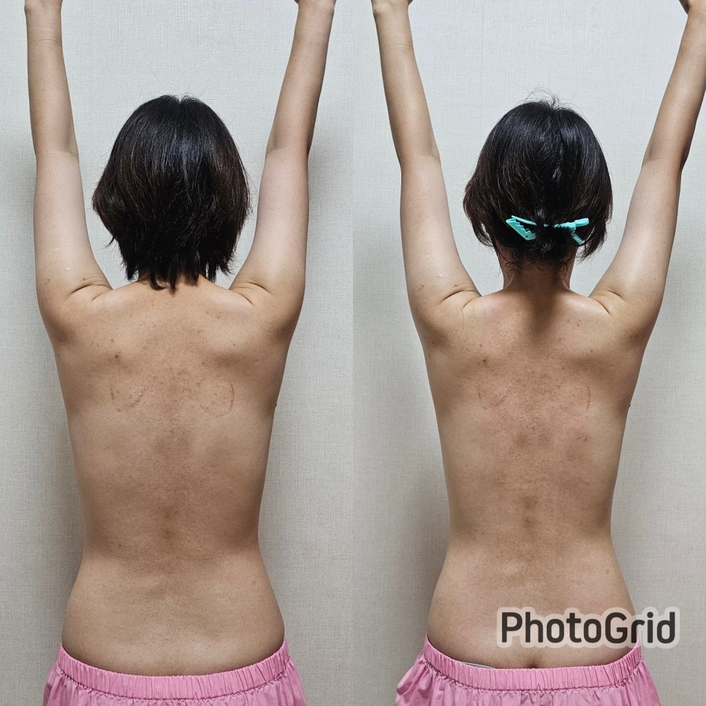 더슬림 림프순환 picture 2