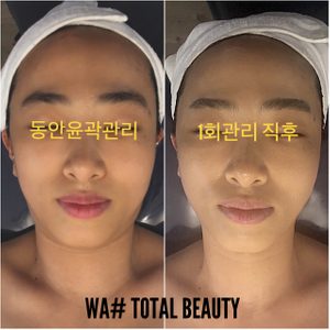 명덕역/작은얼굴만들기/물광피부/문제성피부전문/왁싱전문점