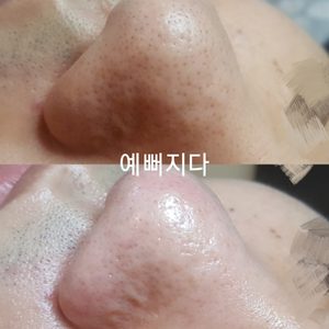 스킨&바디50%이상할인 아쿠아필2만,스킨2만,속눈썹2만♡