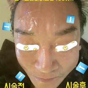 피부관리 행사해요~~♡