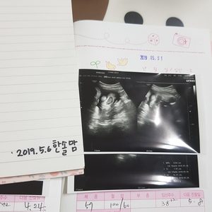 무료나눔 지원 받아요