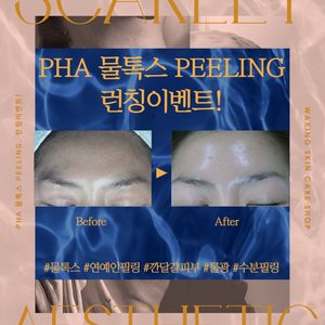 🦋연예인이 받는 관리 물톡스런칭이벤트🦋