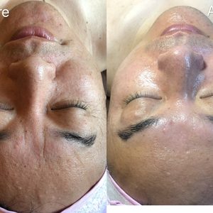 연예인 물광피부,피부관리,피부미용,피부마사지,문제성피부,여드름피부,아토피,피부샾