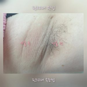 🌈리페어플래닝&👙왁싱👙이벤중입니다