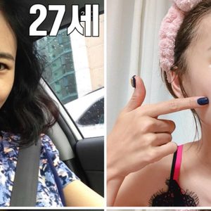 피부관리 및 피부컨설팅 선착순 5명-주름, 모공고민,기미,동안피부 원하시는분